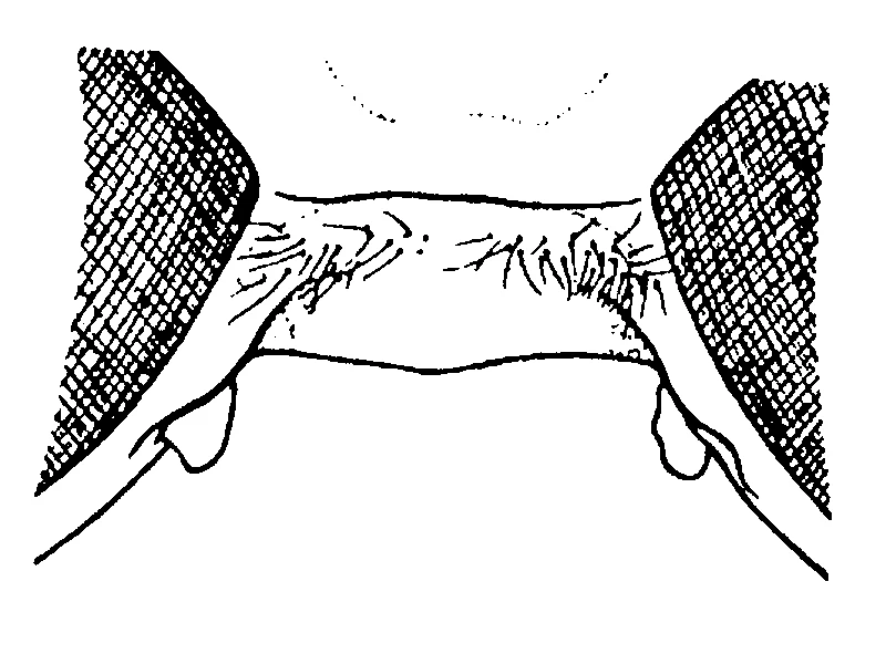 couplet drawing