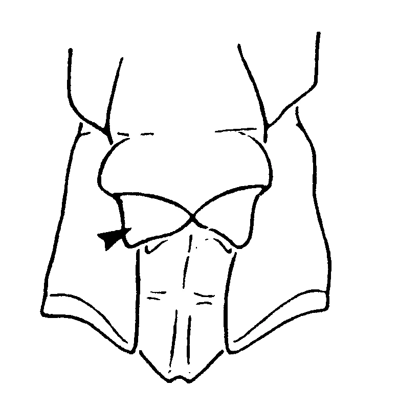 couplet drawing