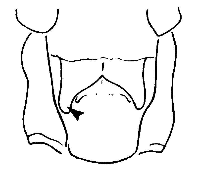 couplet drawing
