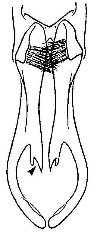 couplet drawing