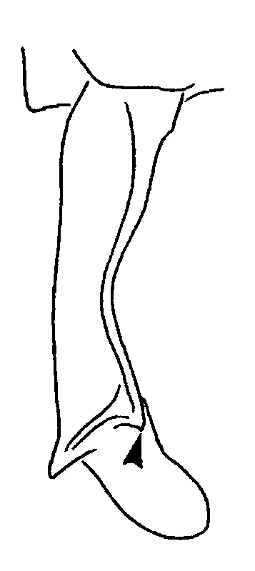 couplet drawing