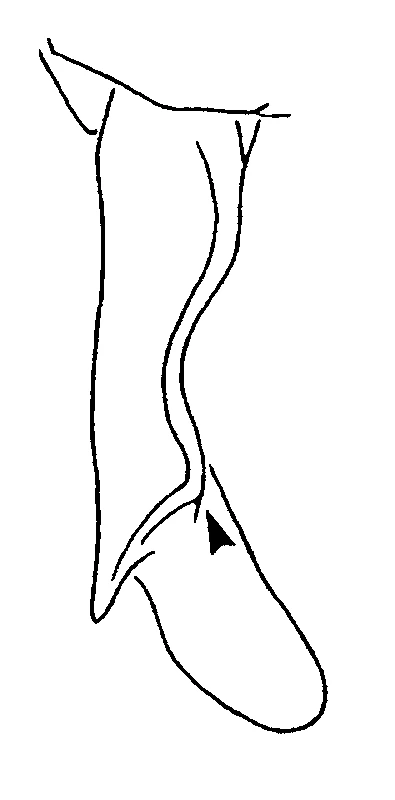 couplet drawing
