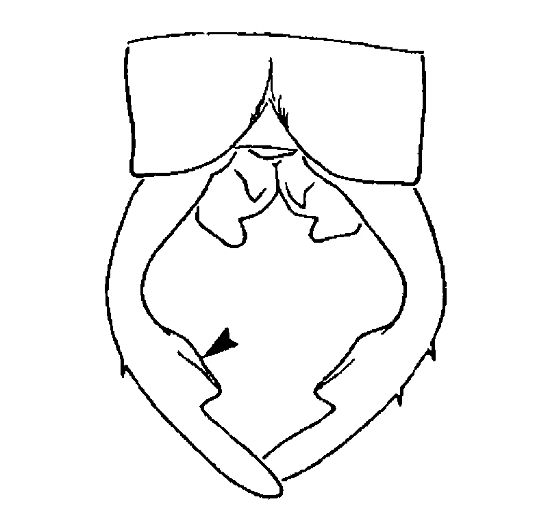couplet drawing