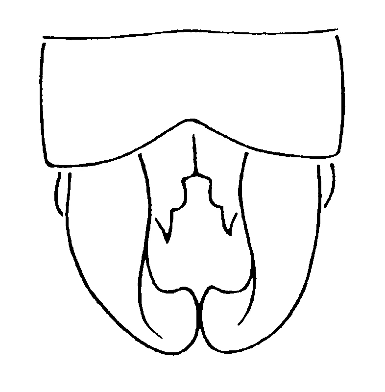 couplet drawing