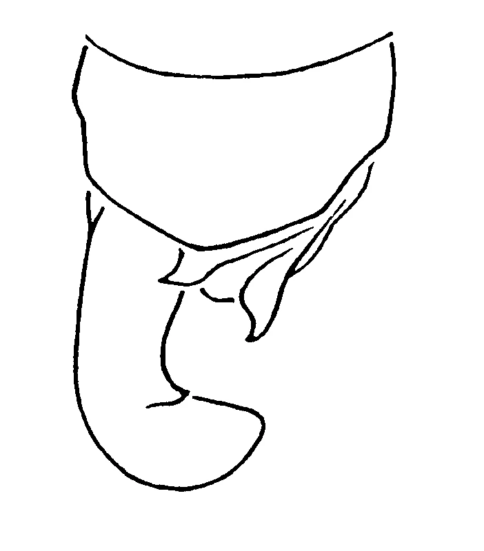 couplet drawing