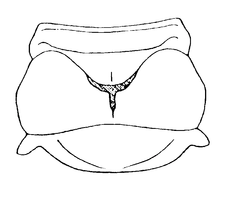 couplet drawing