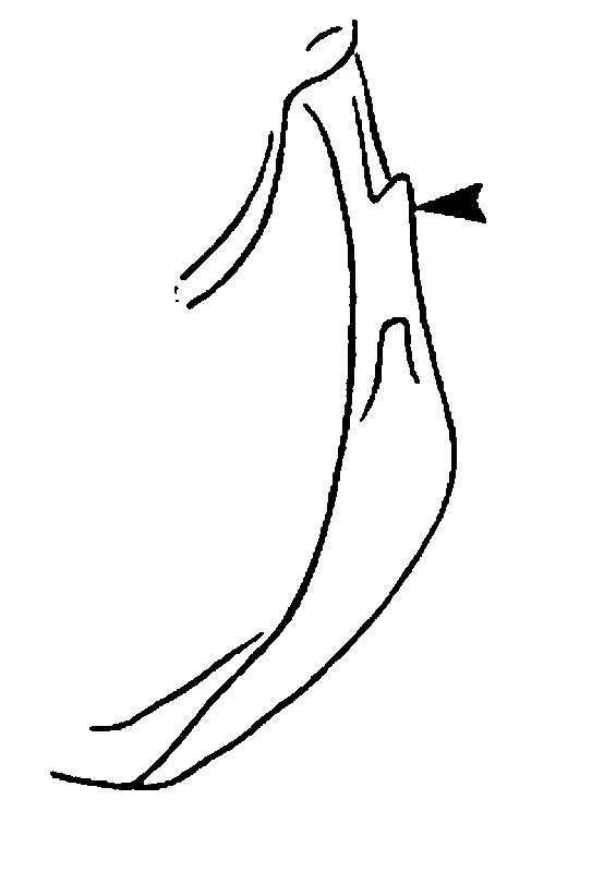 couplet drawing