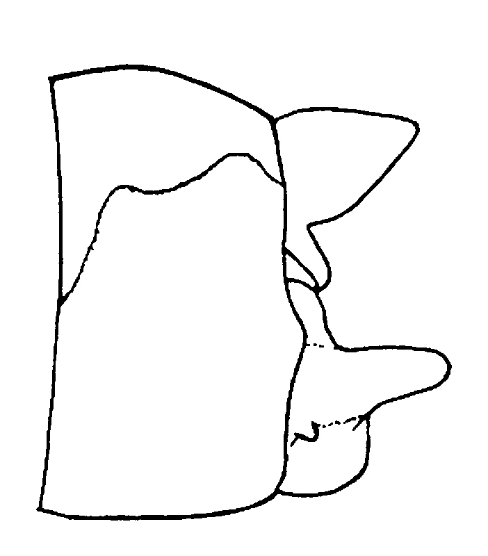 couplet drawing