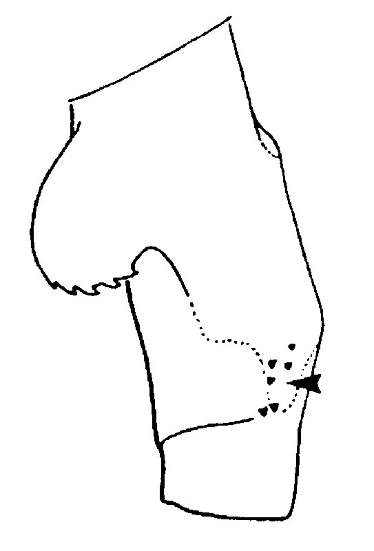 couplet drawing