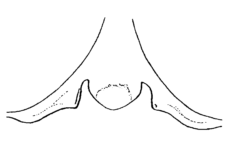 couplet drawing