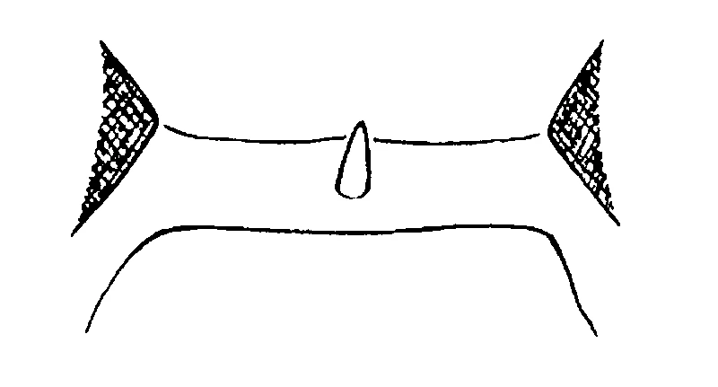 couplet drawing