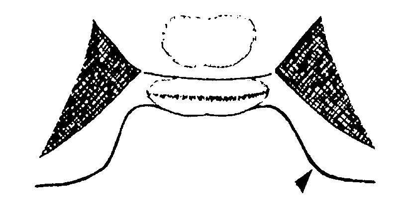 couplet drawing
