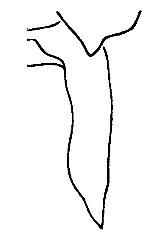 couplet drawing