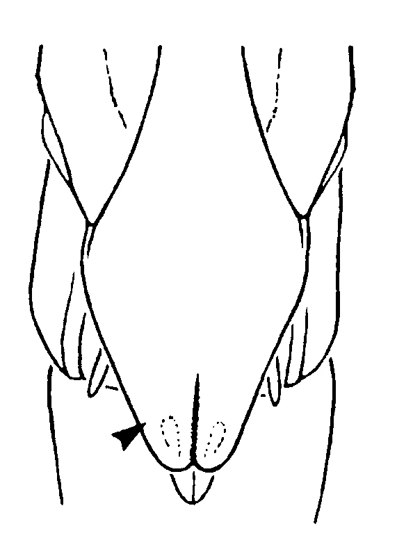 couplet drawing