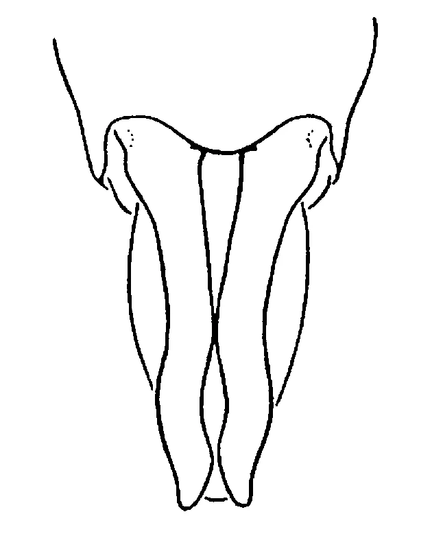 couplet drawing