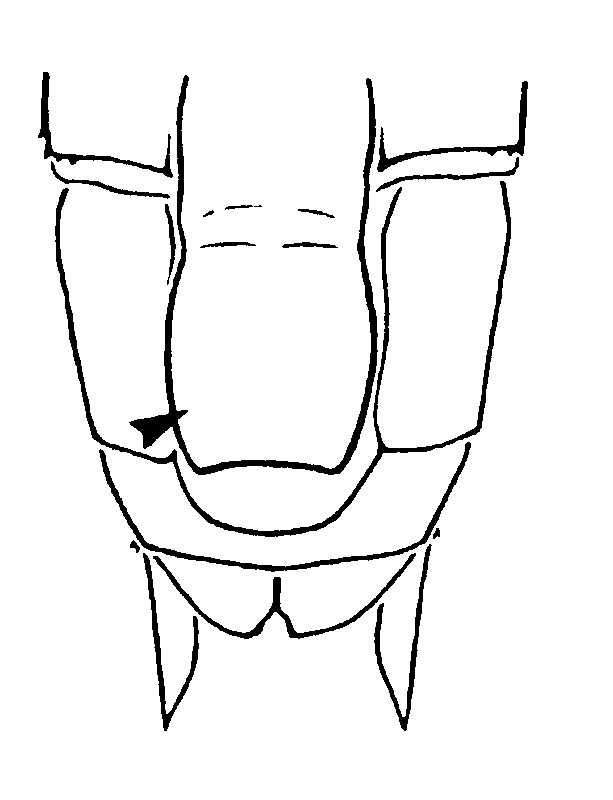 couplet drawing