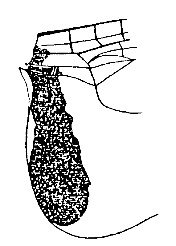 couplet drawing