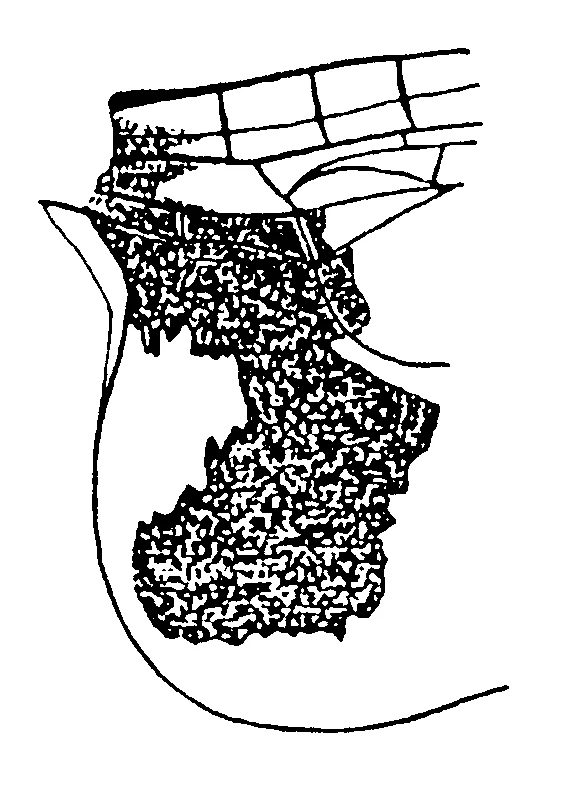 couplet drawing