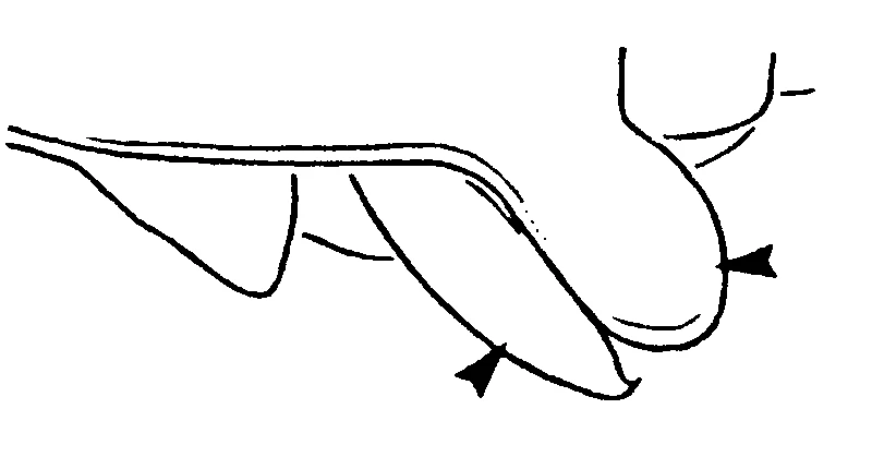 couplet drawing