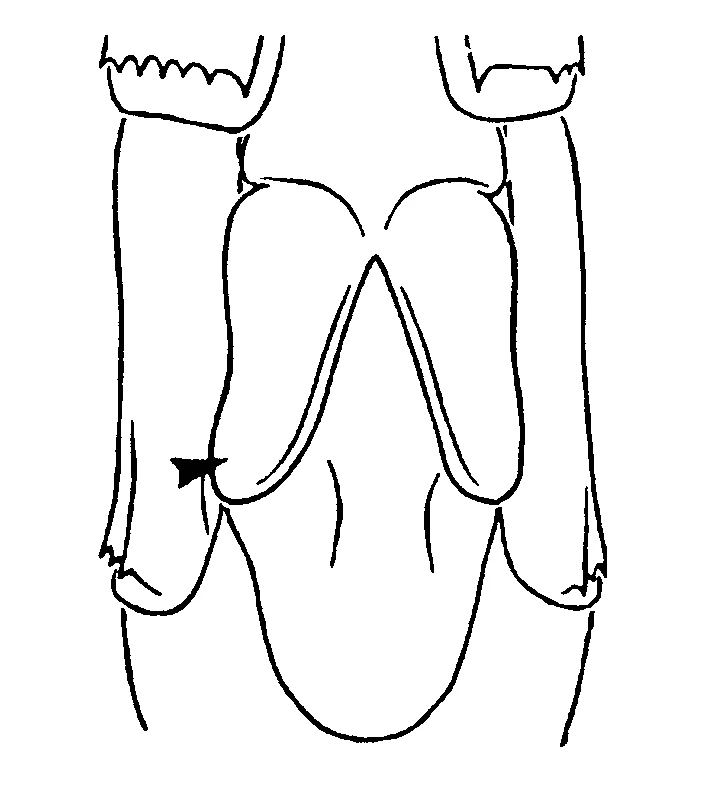 couplet drawing