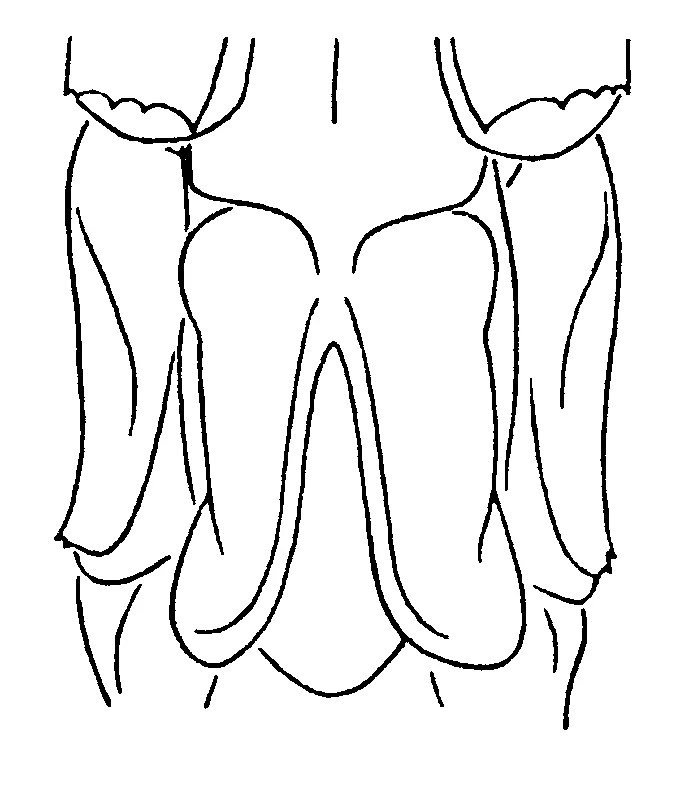 couplet drawing